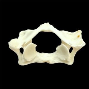 Beaver Bone:  Atlas