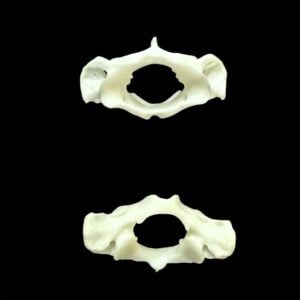 Ermine / Weasel Bone:  Atlas