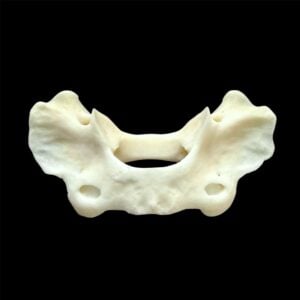Fox Bone:  Atlas