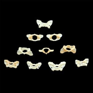 Marten Bone:  Atlas